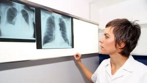 pulmonar, clínica, médico, EPOC