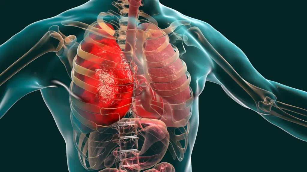 Ventilación pulmonar