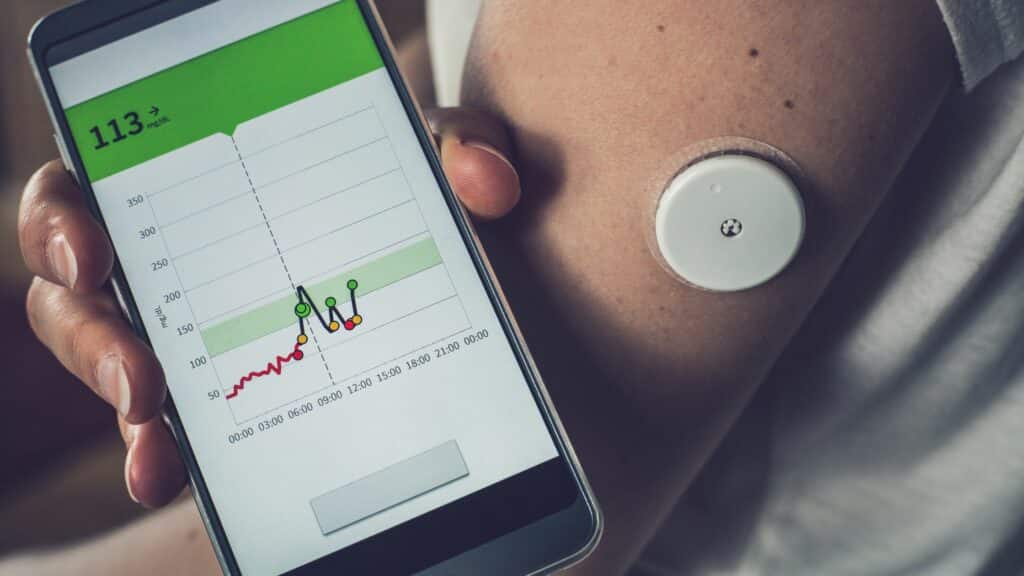 monitorización de la glucosa