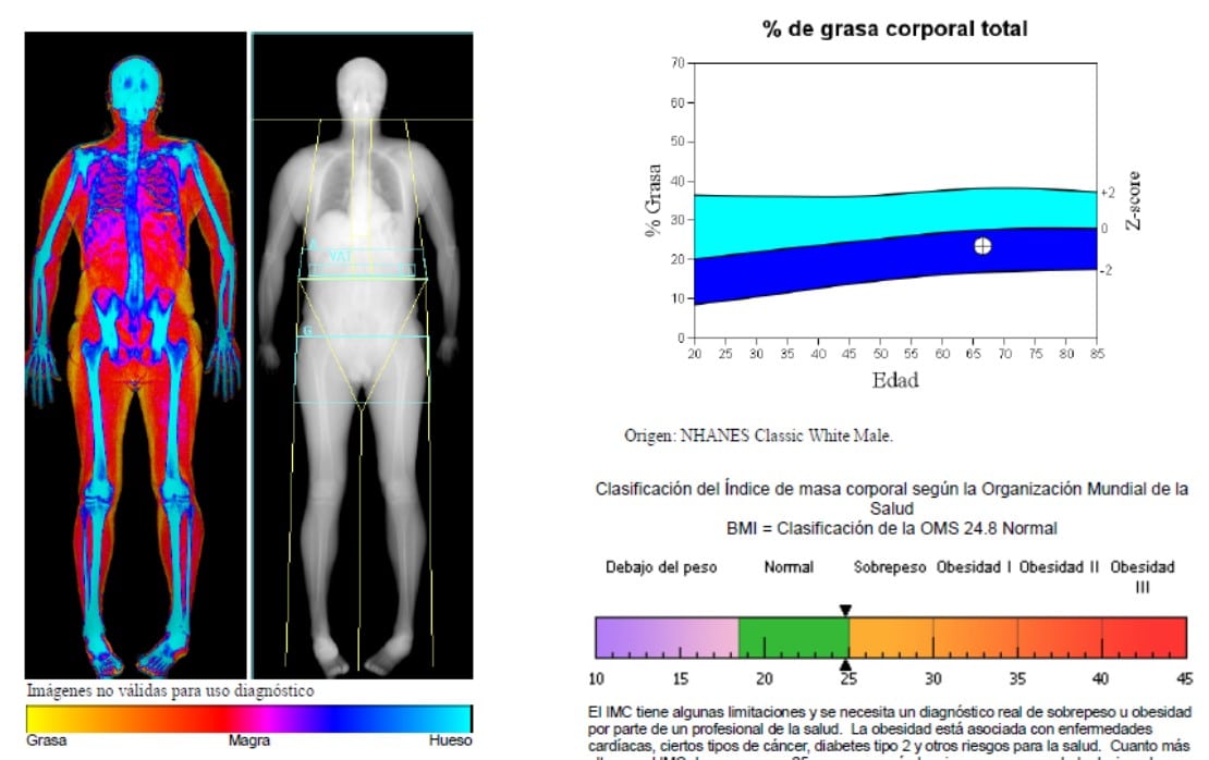 DXA Como M todo De Valoraci n De La Composici n Corporal Fisiolog a 