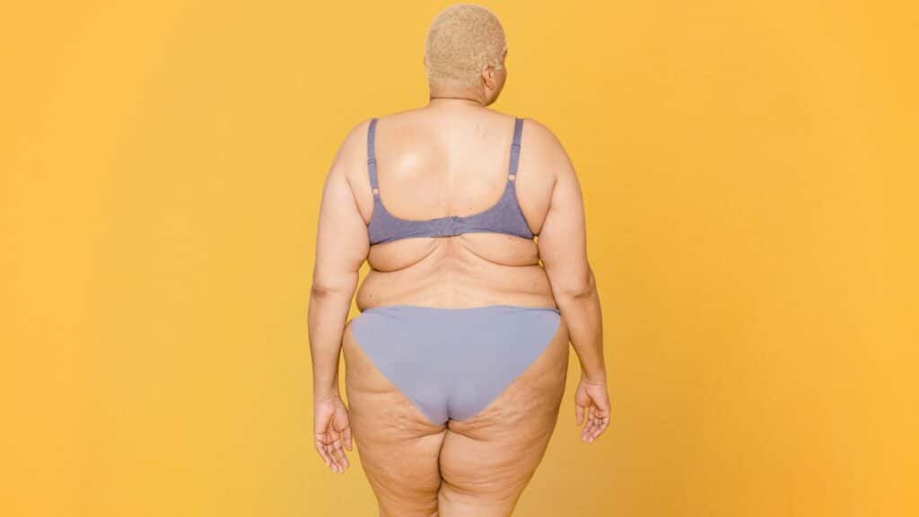 Obesidad y modalidad de ejercicio