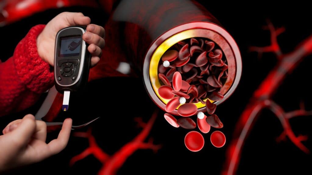 Niveles de hemoglobina en diabetes