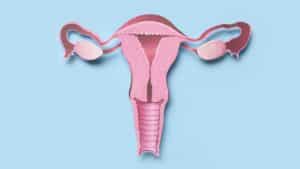 Ovario poliquístico y ejercicio