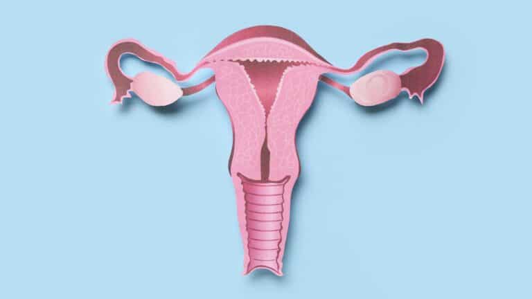 Ovario poliquístico y ejercicio